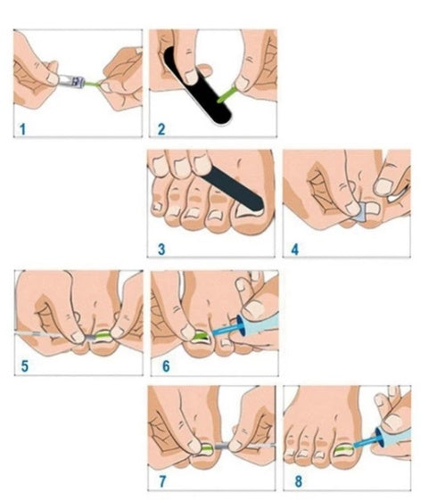 Parche para uñas 